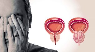 Frisk och inflammerad prostata
