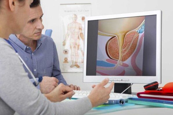 läkaren konsulterar patienten i fråga om prostatit