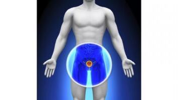 prostatit hos en man