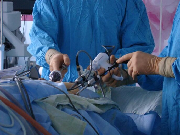 kirurgisk behandling av prostatit