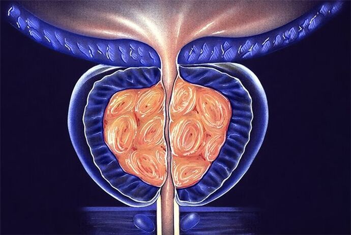 symtom och behandling av prostatit