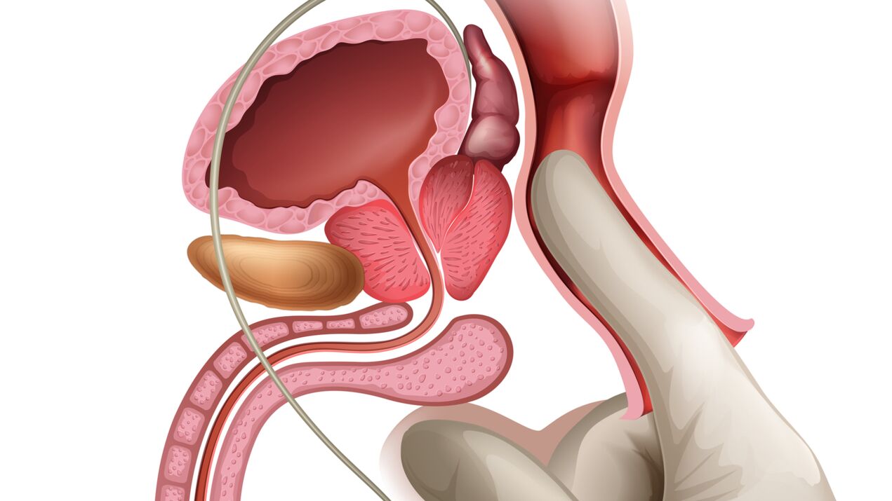Prostatamassage är ett effektivt sätt att behandla kongestiv prostatit